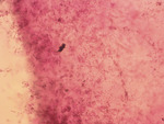 MISSING THUMBNAIL